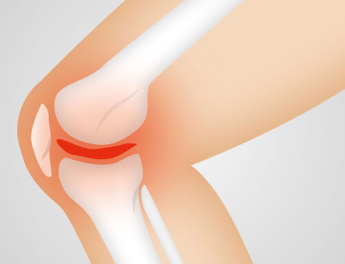 Forschungsprojekt sagt Arthroseschmerzen den Kampf an